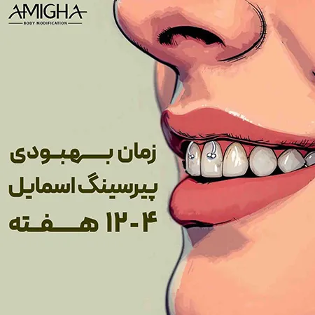 زمان بهبودی پیرسینگ اسمایل