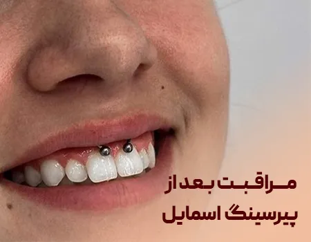 پیرسینگ اسمایل