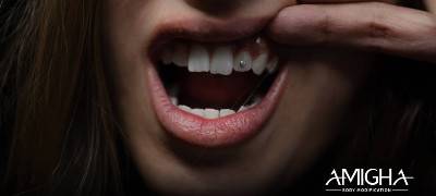دوره آموزشی کاشت نگین و جواهرات دندان