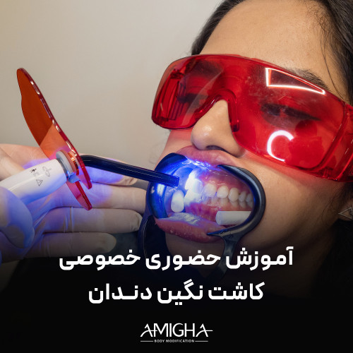 آموزش حضوری - خصوصی کاشت نگین دندان