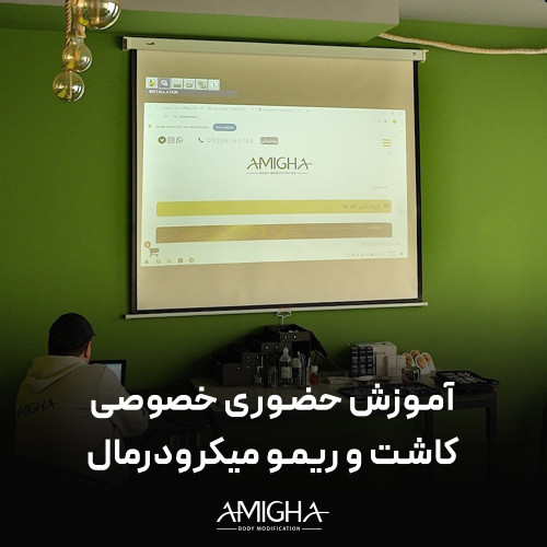 آموزش حضوری - خصوصی کاشت و ریمو میکرودرمال