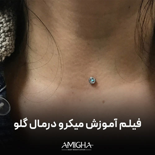 فیلم آموزش میکرودرمال - گلو