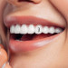 نگین دندان بیضی کد 2245