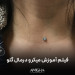فیلم آموزش میکرودرمال - گلو